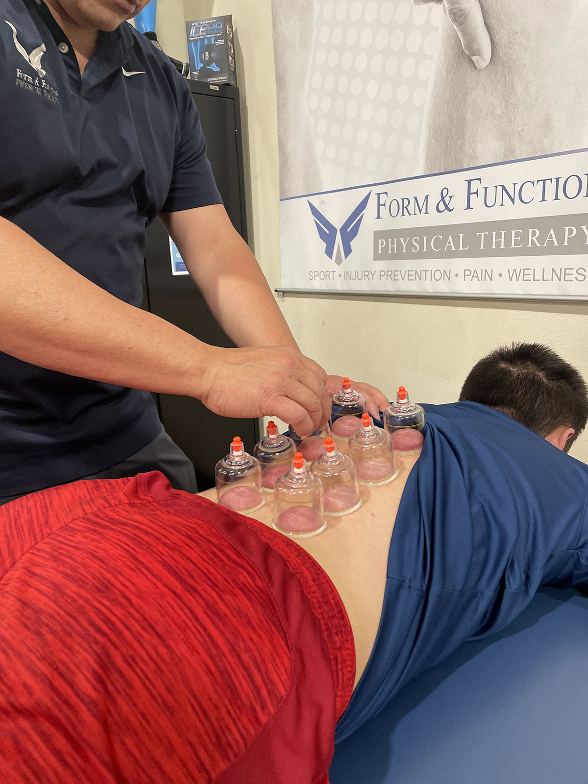 Form Function Cupping